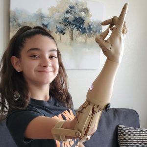 Unlimited Tomorrow designs personalized prosthetics to empower amputees
